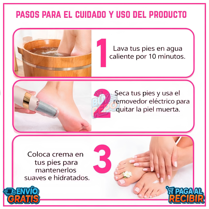 SoftFeet™ 🦶 - Removedor de callos eléctrico ✨