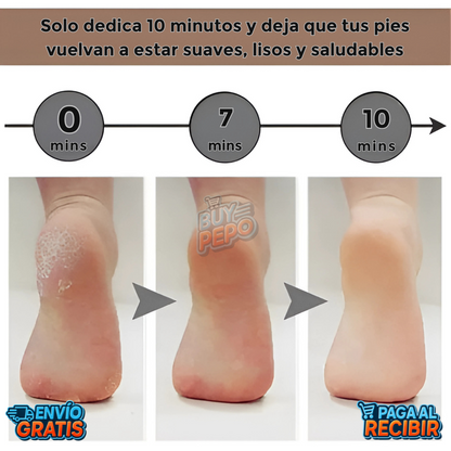 SoftStep™ 🌟 - Lima eléctrica pies suaves ✨